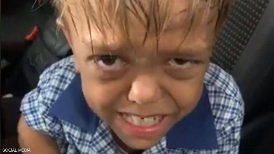 الطفل الأسترالي ضحية التنمر...كيف تغيرت حياته بمقطع فيديو؟