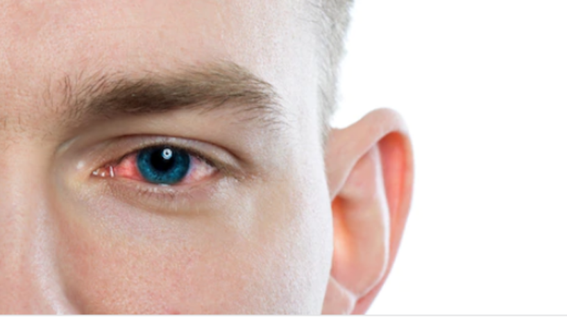 دراسة طبية حديثة : فيروس كورونا يدخل من العين والدموع تنقل العدوى
