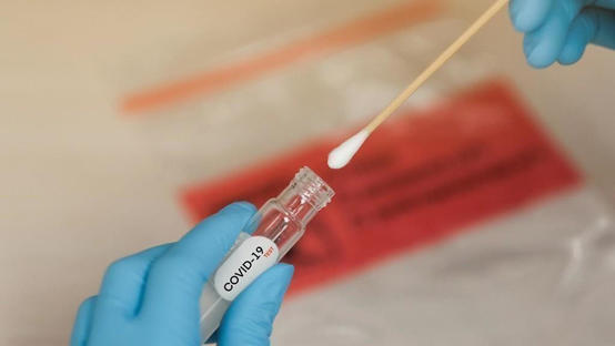 تسجيل 62 إصابة محلية جديدة بفيروس كورونا في الاردن