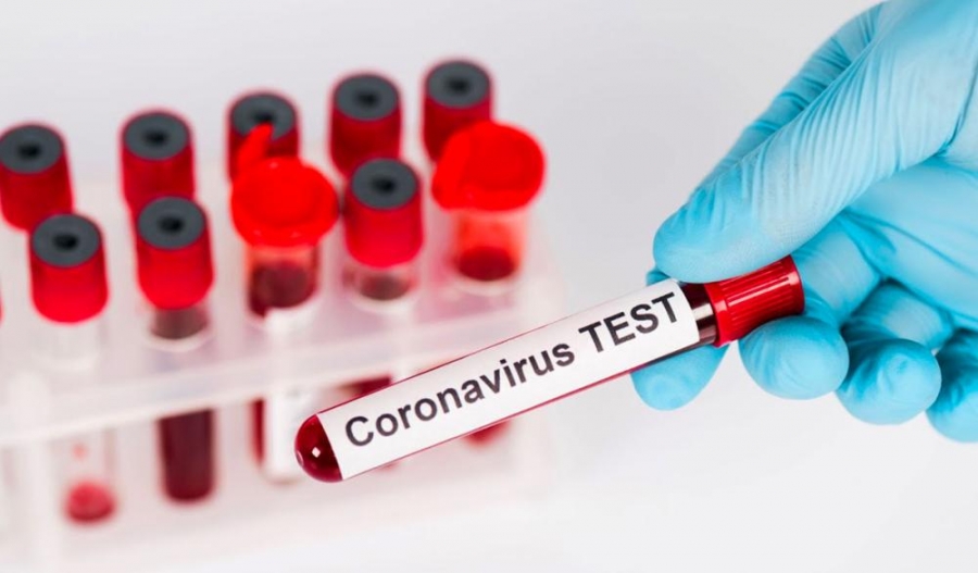 ارتفاع عدد اصابات فيروس كورونا الى ٢٥ اصابة في اربد