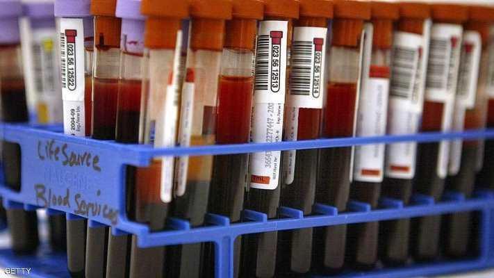 علماء يكشفون فصيلة الدم الأكثر خطورة