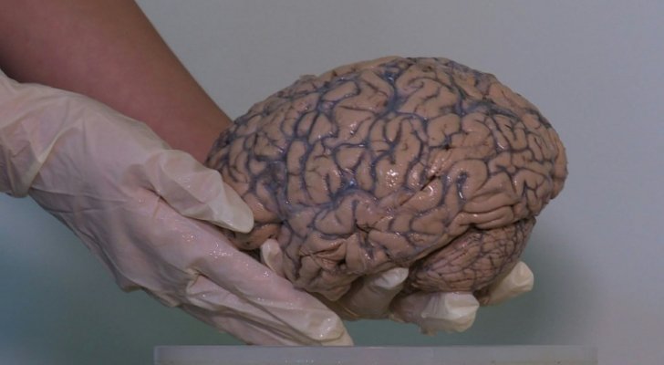 ما سبب كبر حجم دماغ الإنسان مقارنة بالقرود؟ علماء يجيبون