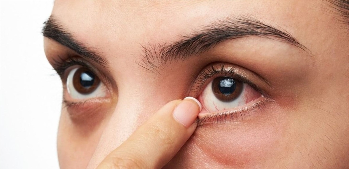 جفاف العين يؤثر سلبًا على الصحة الجسدية والعقلية