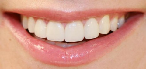 كيف تتغير الأسنان مع تقدمنا في العمر وكيف نحافظ على ابتسامة صحية وجميلة؟
