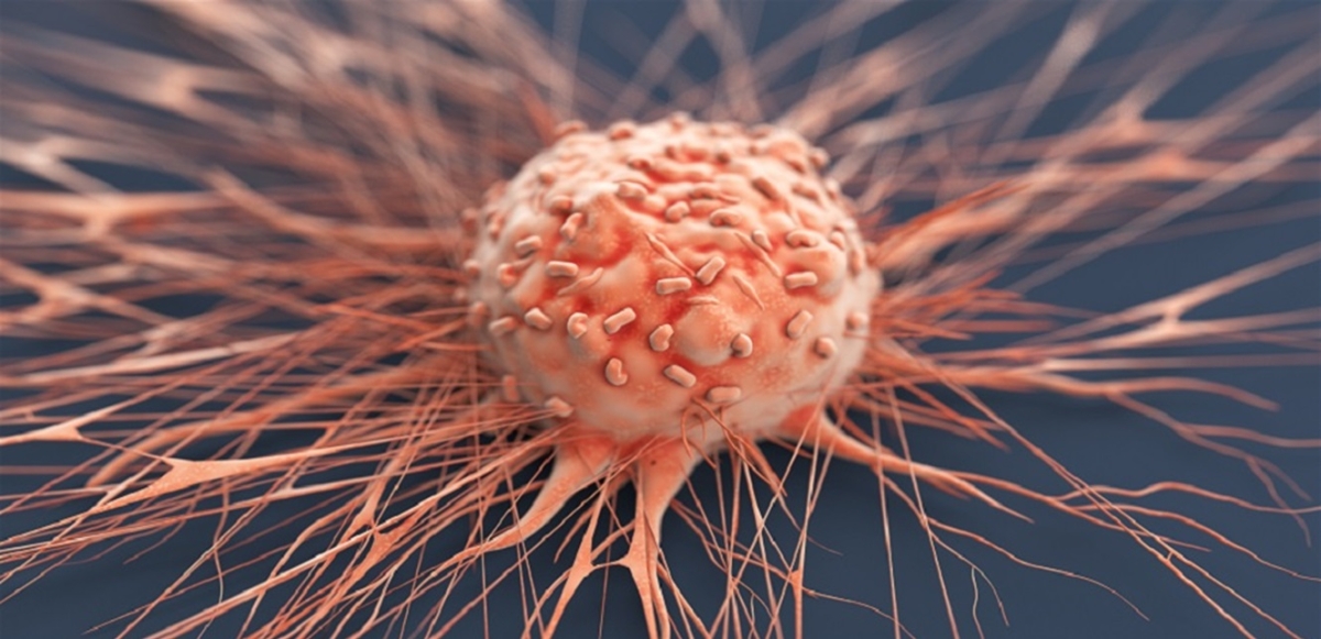 باستخدام الجزيئات الدقيقة... علماء يُدمّرون خلايا السرطان