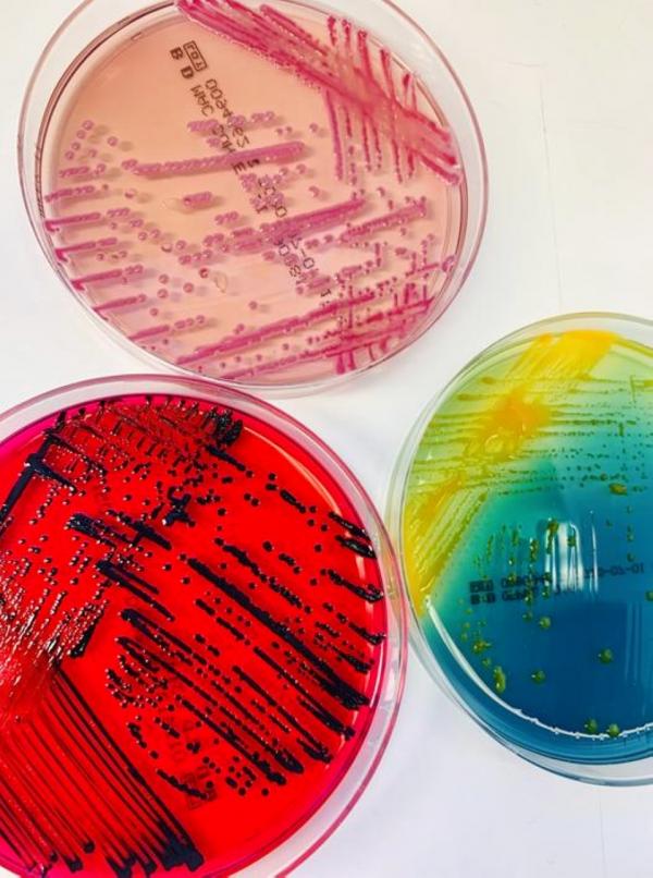 اكتشاف 30 نوعاً جديداً من البكتيريا