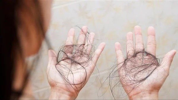 3 طرق سحرية للتخلص من تساقط الشعر