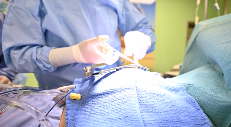 عملية جراحية نوعية لاستئصال ورم في المريء باستخدام المنظار الجراحي في مستشفى الجامعة الأردنية