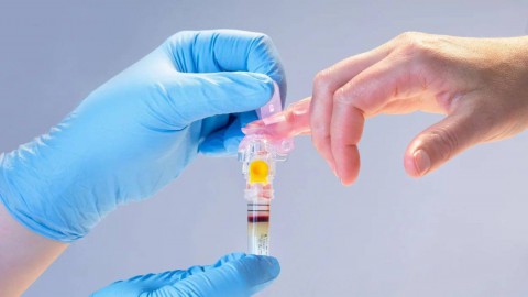 ابتكارات حديثة في تقنيات اختبارات الدم