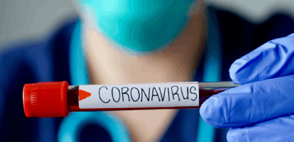 توصية مُفاجئة بشأن فيروس كورونا...وخبراء يرفضونها!