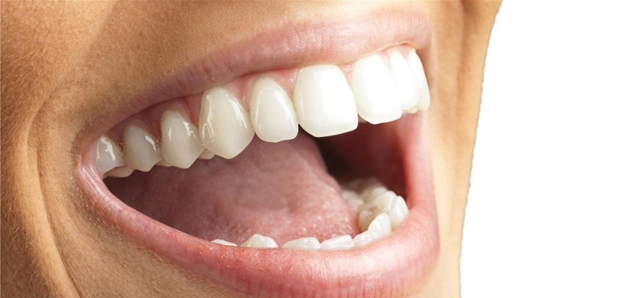 كيف تحافظ على صحة أسنانك أثناء الصيام؟