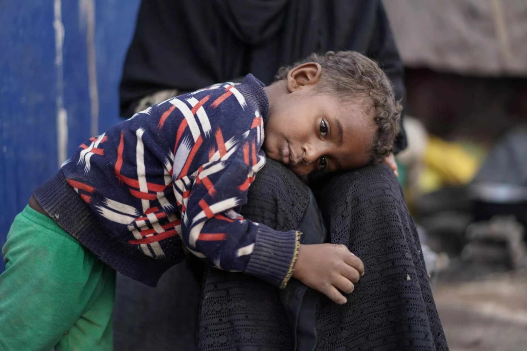 الاورومتوسطي: أرقام المنظمات الدولية لا تعكس حجم كارثة الأزمة الإنسانية في اليمن