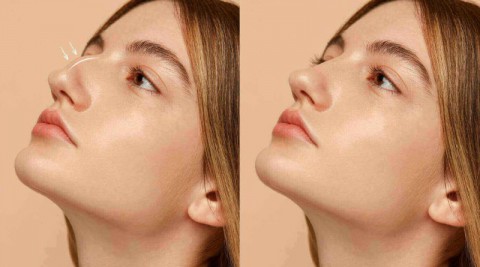 استكشفي أفضل الخيارات التجميلية لتحسين شكل أنفك
