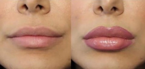 طرق طبيعية وفعّالة لتكبير الشفايف بشكل دائم