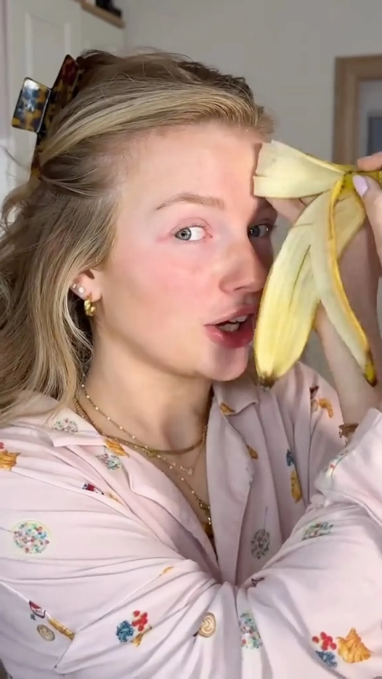 هل قشرة الموز بديل طبيعي للبوتوكس؟ تيك توكرز يروّجون وأطباء يوضحون