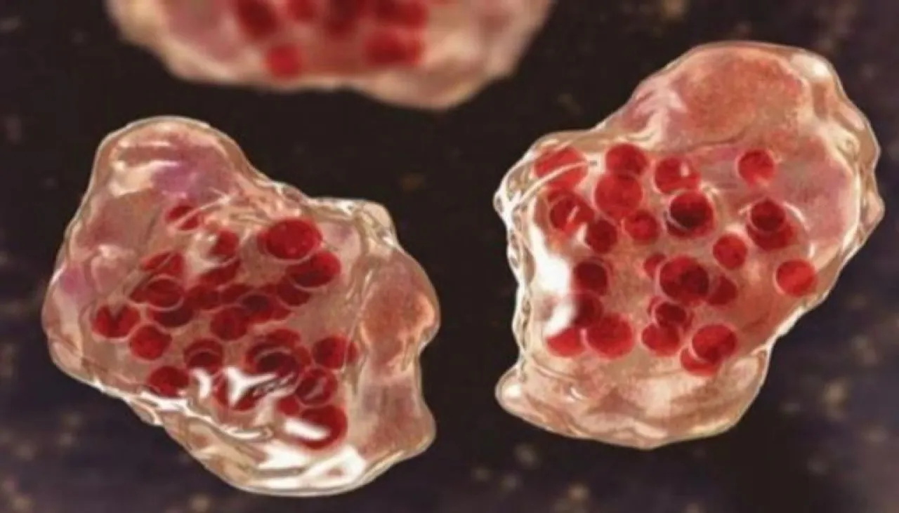 الحصبة تنتشر في أمريكا.. أكثر من 700 إصابة في ولايات مختلفة