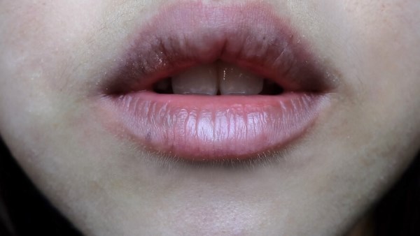 سواد الشفايف مشكلة مزعجة ومحرجة .. ما أسبابها؟