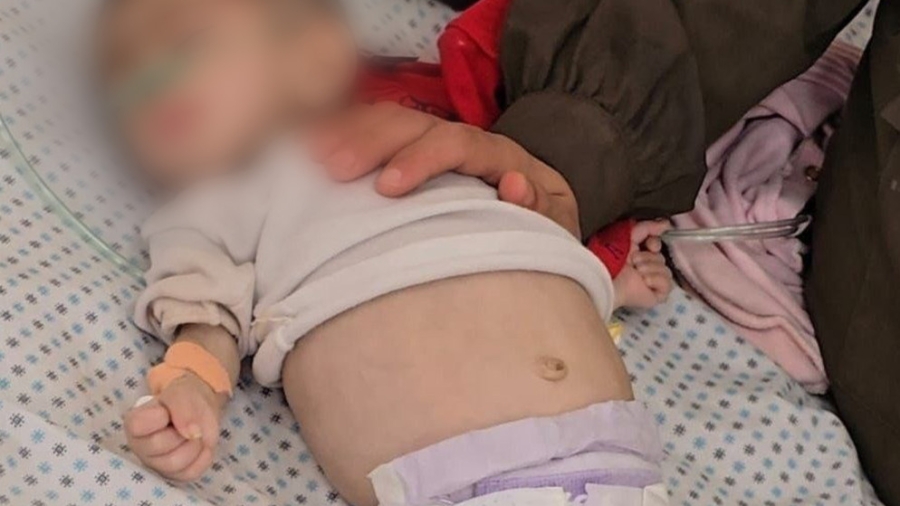 وفاة طفلة في مدينة غزة بسبب المجاعة والجفاف