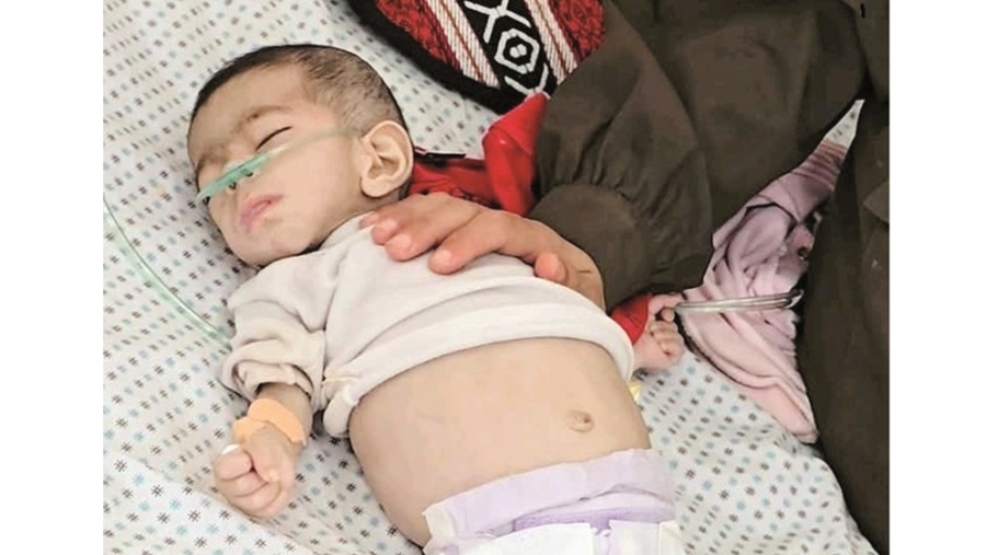 أطفال غزة يتساقطون جوعا .. 51 قضوا والمأساة مستمرة