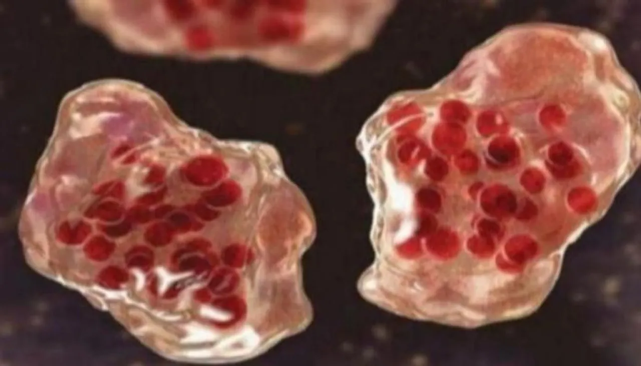 تفشي الحصبة في الكيان الصهيوني .. 32 إصابة مؤكدة ومخاوف بشأن اللقاحات