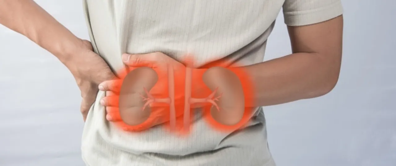 نجاح أول عملية زرع مثانة بشرية يمنح الأمل لمرضى الفشل الكلوي