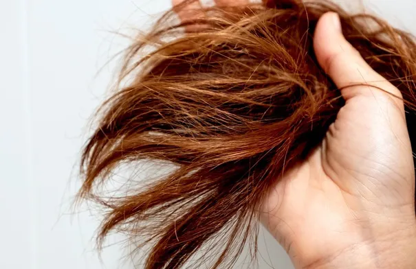 مع حرارة الصيف.. 5 خطوات بسيطة تمنع تساقط الشعر وتعزز نموه