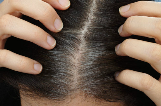 4 خطوات تقلل من شيب الشعر وتجعله صحيا وحيويا