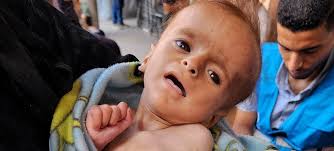 الأونروا: أطفال غزة يذبلون ويموتون جوعا أمام أعين الأطباء