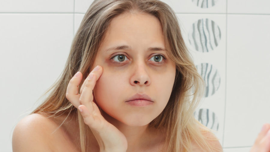 هل السهر يسبب الهالات السوداء حقاً؟