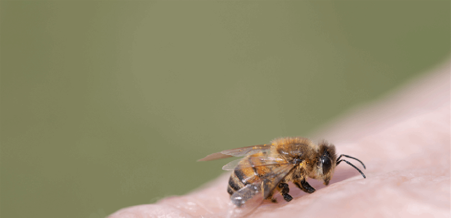 ابن السنتين توفي بطريقة مروعة .. تعرّض لهجوم عنيف من سرب دبابير