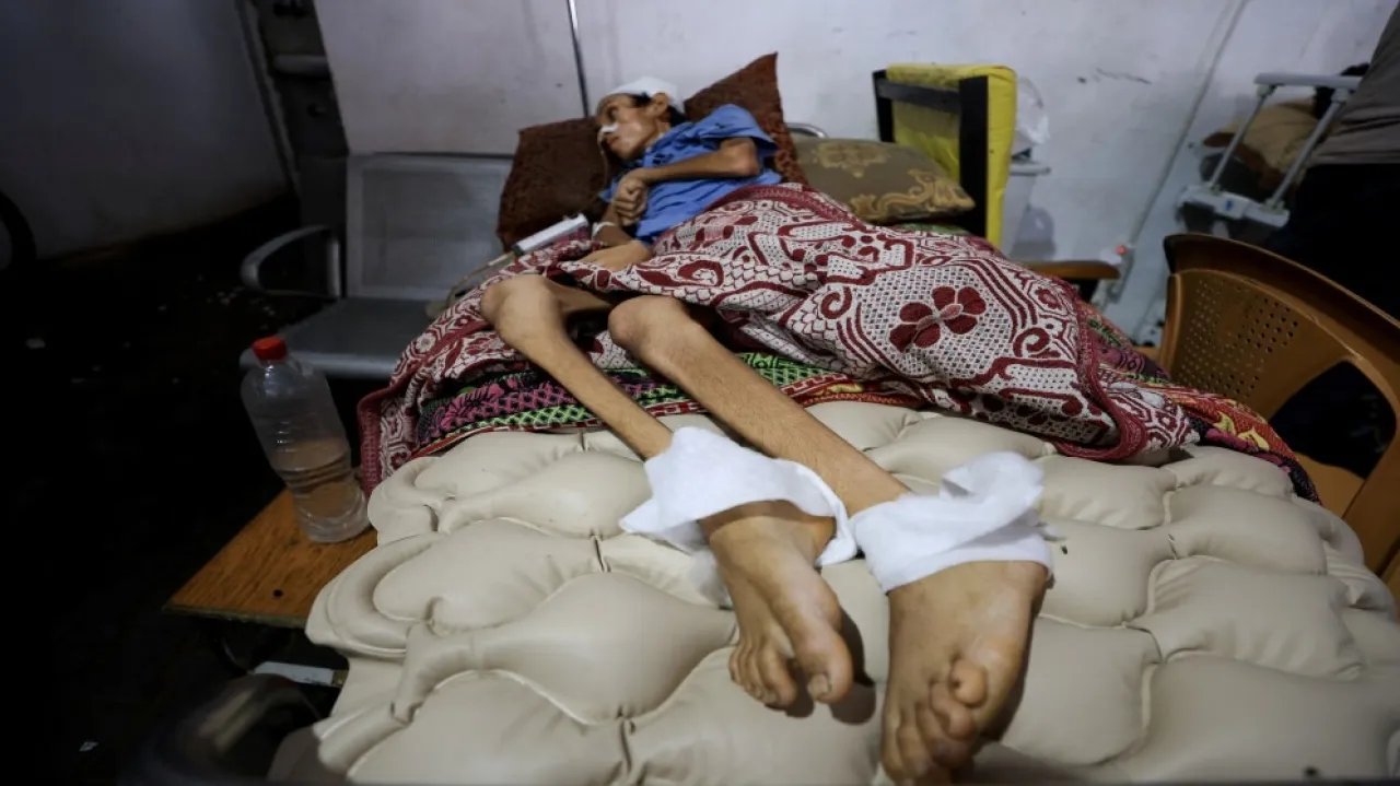 صحة غزة : تسجيل 45 حالة شلل رخو حاد خلال حزيران وتموز