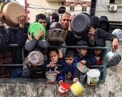 وفاة 84 طفلا نتيجة سوء التغذية في غزة