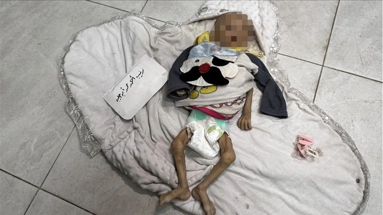 الرضيعة زينب أبو حليب .. ضحية جديدة لتجويع غزة