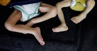 وفاة فلسطيني بسبب  التجويع  في القطاع