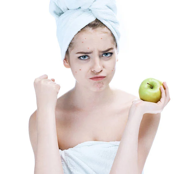 وصفات طبيعية لتهدئة الحبوب الملتهبة في الحر.. بدون مواد كيميائية