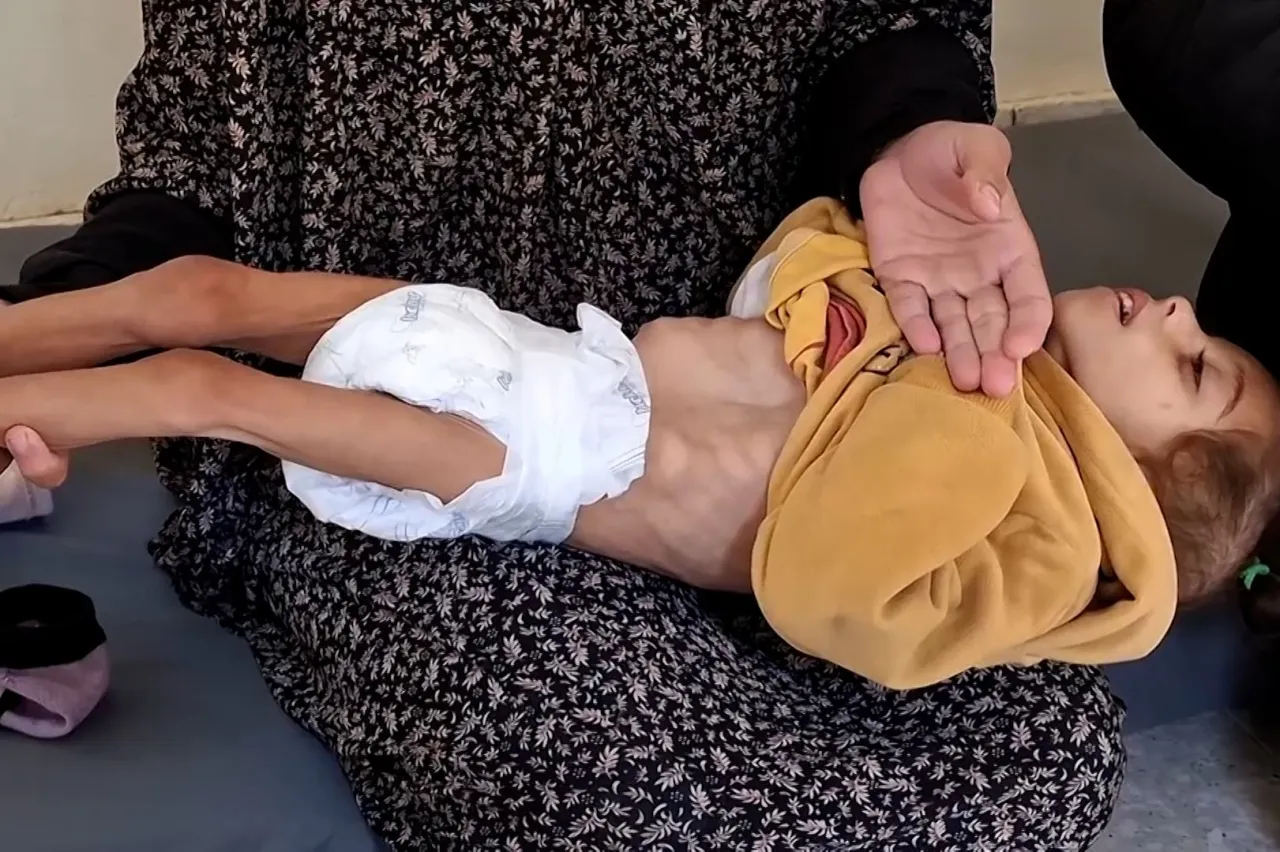 وفاة طفل آخر في غزة نتيجة الجوع وسوء التغذية