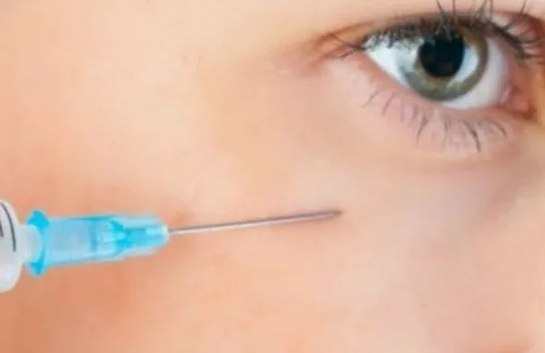 العلاج بالإبر الدقيقة للهالات السوداء: حل فعّال دون جراحة