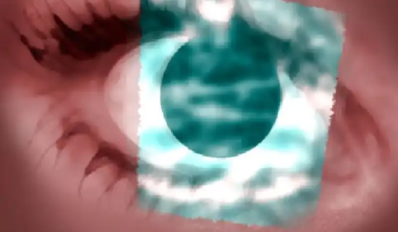 بعد 10 سنوات من العمى.. سبعينية تستعيد بصرها عبر سنّها بفضل جراحة نادرة