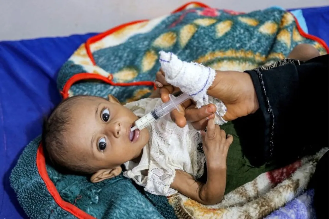 الأمم المتحدة: أزمة جوع حاد تهدد 18 مليونا باليمن