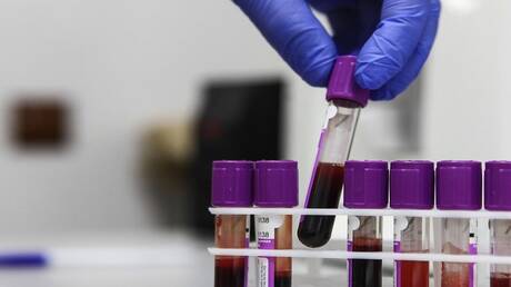 عالم أمريكي يفجر مفاجأة كبرى عن منشأ كورونا ويحدد دولة عظمى صدرت الفيروس للعالم