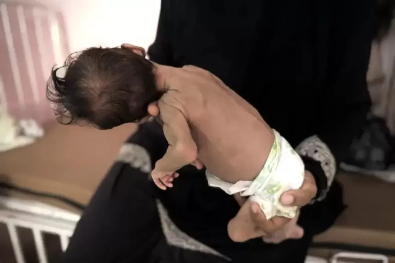 39 وفاة بالتجويع منذ إعلان المجاعة في غزة