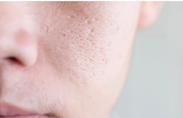 وصفات طبيعية فعالة لتقليل المسام الواسعة وتنظيف البشرة بعمق