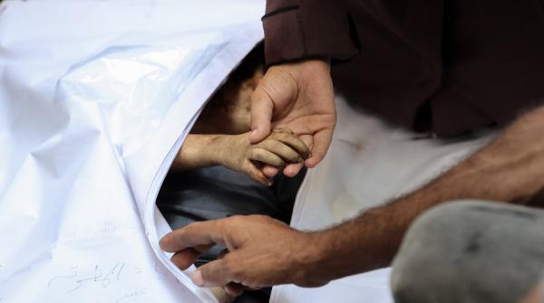 صحة غزة: 6 وفيات نتيجة المجاعة وسوء التغذية بينها طفل