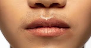 اسمرار منطقة حول الفم: الأسباب والحلول الطبيعية والطبية لاستعادة إشراقة البشرة