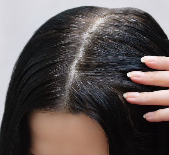 وصفات طبيعية للتخلص من الشيب المبكر فى الشعر