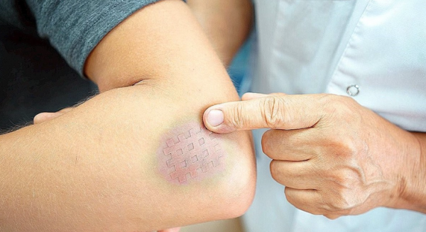 كدمات مريض السكري .. 5 أسباب وراء هشاشة الأوعية