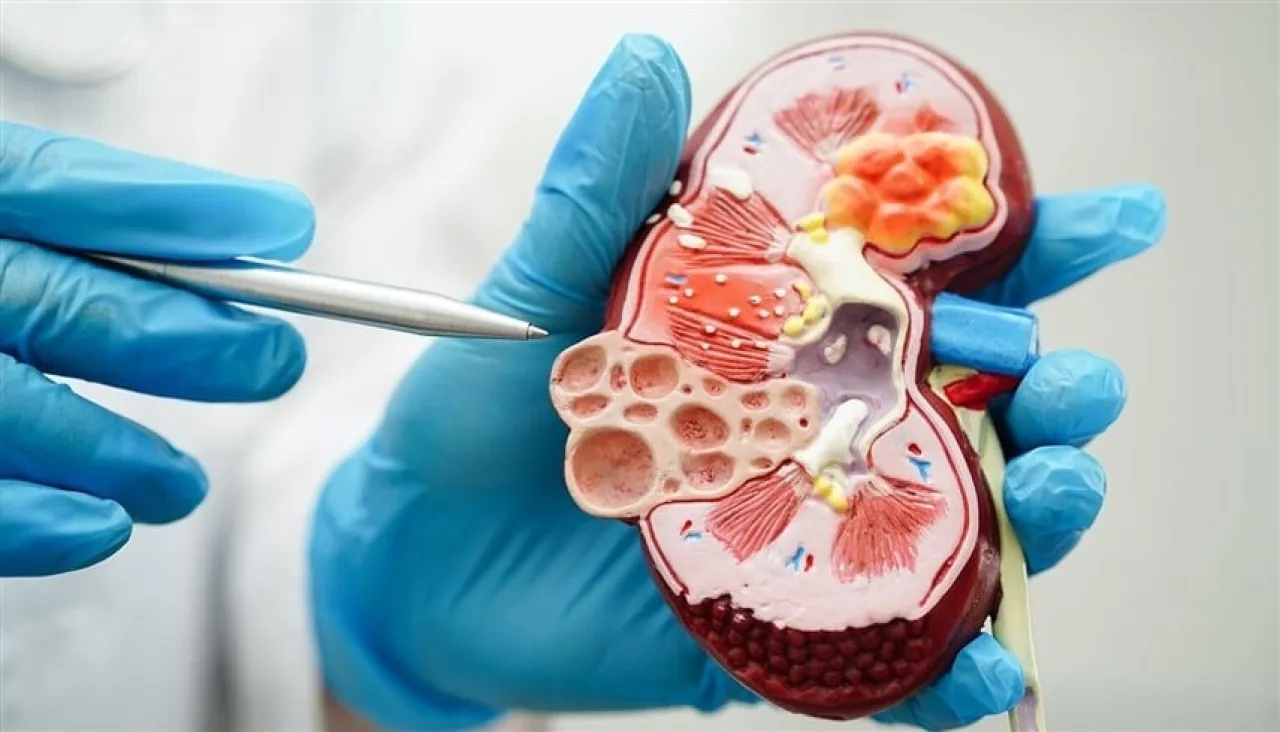 ارتفاع عالمي للإصابات بمرض قاتل يدخل ضمن أبرز 10 أسباب للوفيات