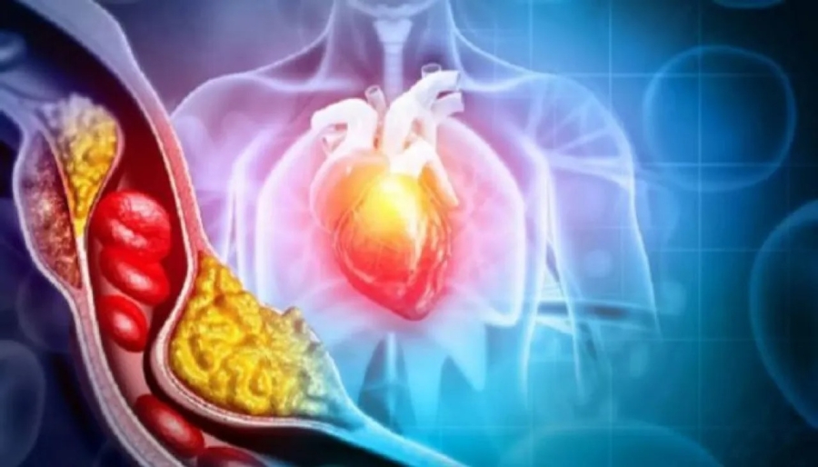 دواء جديد يخفض الكوليسترول «الضار» بنسبة تصل إلى 60