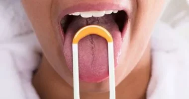 ما هو سرطان اللسان والبلعوم الفموى.. أبرز العلامات التحذيرية