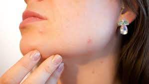 ماسك صباحي لا تستغني عنه لترطيب البشرة في الشتاء